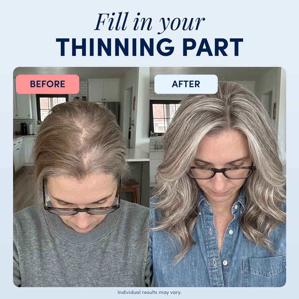 Hair Growth Serum