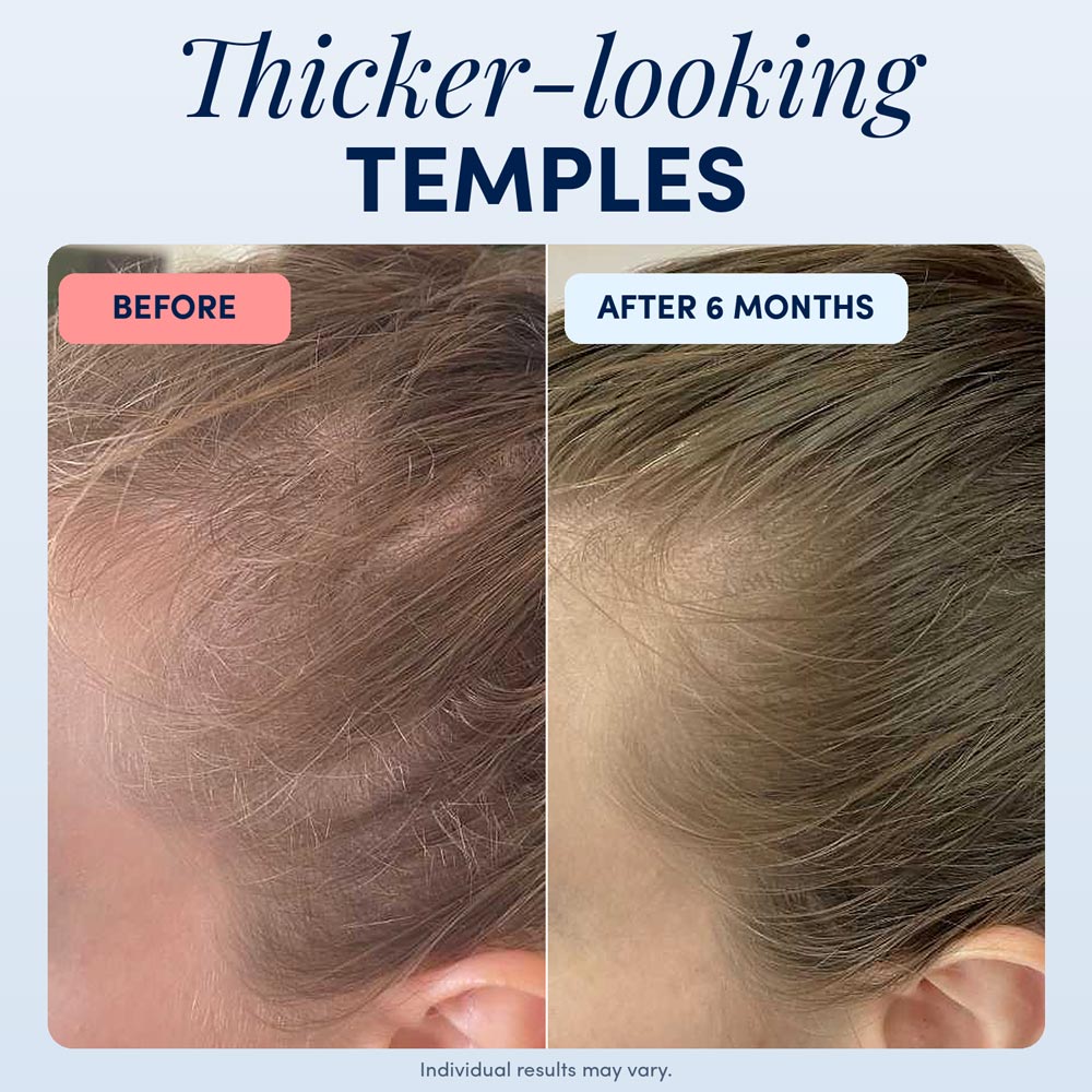 Hair Growth Serum