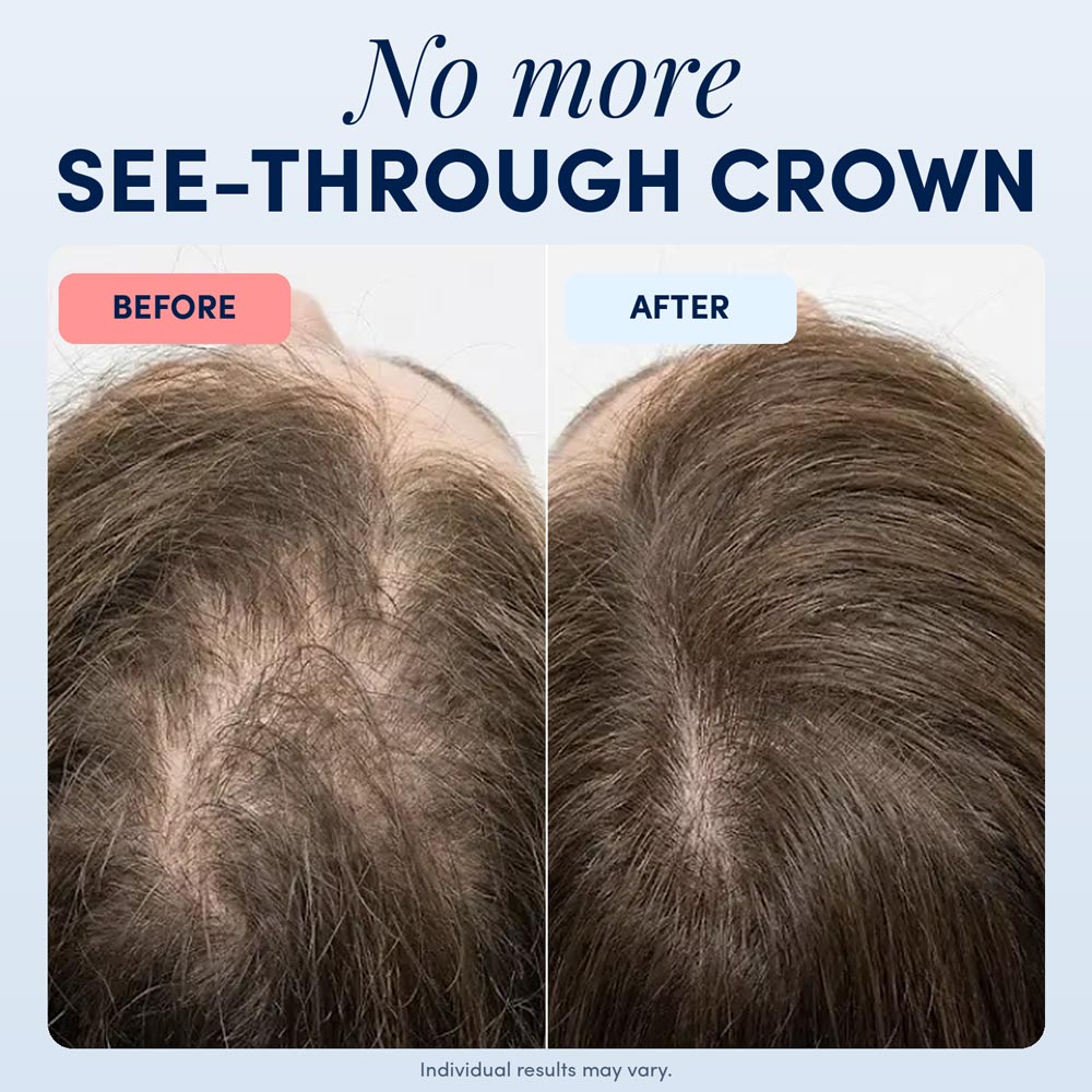 Hair Growth Serum