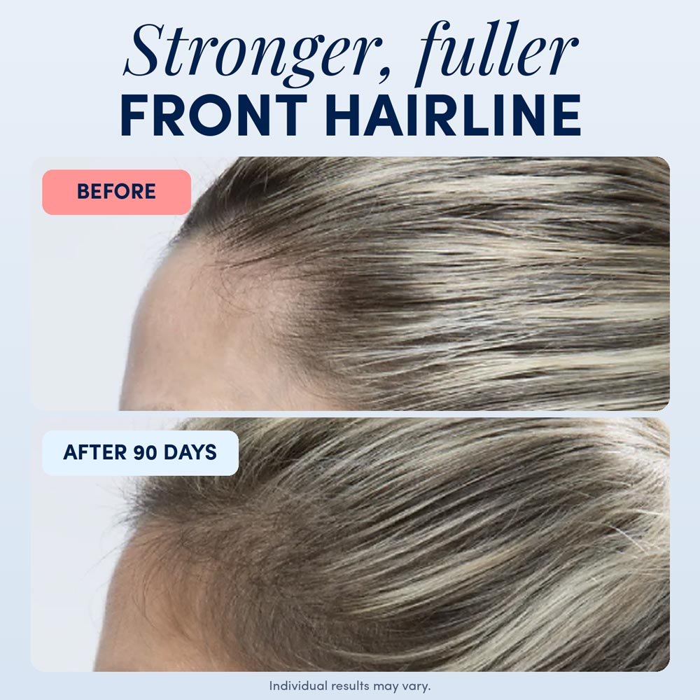 Hair Growth Serum