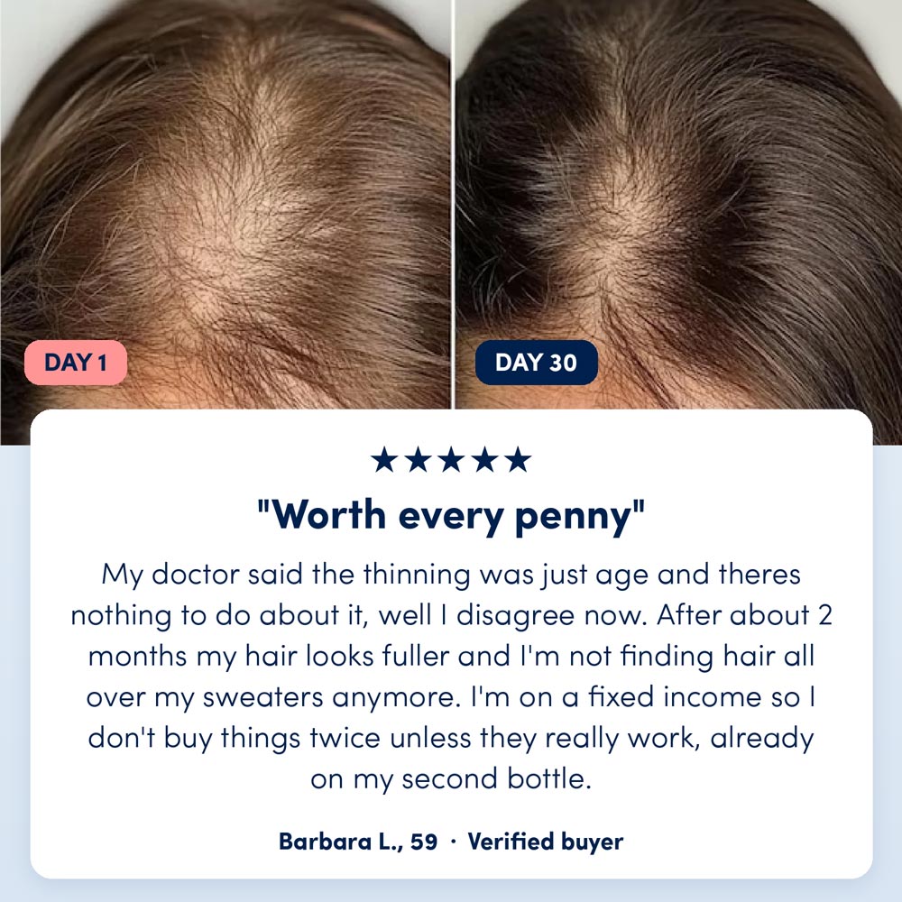 Hair Growth Serum
